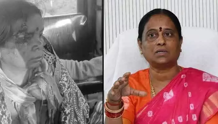 మహిళపై చిరుత పులి దాడి.. స్పందించిన మంత్రి సురేఖ మహిళపై చిరుత పులి దాడి.. స్పందించిన మంత్రి సురేఖ