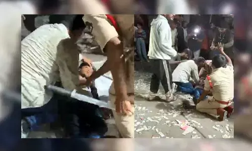 Sandhya Theatre stampede : సంధ్య థియేటర్‌ తొక్కిసలాట ఘటన.. బాలుడి పరిస్థితి విషమం