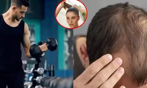 Gym mistakes : జిమ్‌కు వెళ్లే వారిలో బట్టతల వచ్చే చాన్స్.. ఈ పొరపాట్లే కారణం!