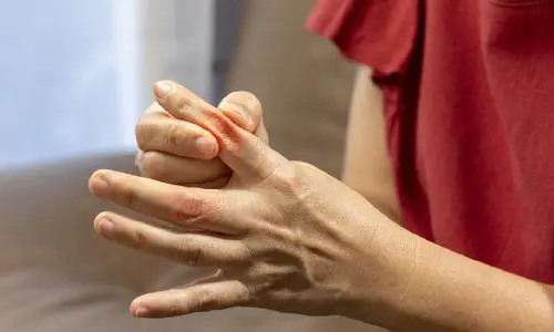 Uric acid: యూరిక్‌ యాసిడ్‌ తో బాధ పడుతున్నారా.. అయితే, ఈ నీటితో తగ్గించుకోండి!