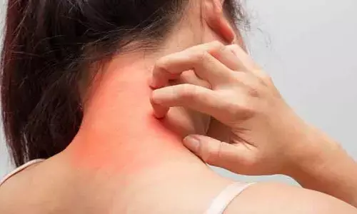 Eating Mistakes: అలర్జీ బారిన పడటానికి ముఖ్య కారణం..!