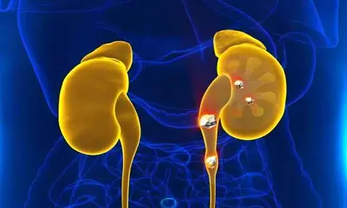 kidney stones: ఈ ఐదు రకాల కూరగాయలు తింటున్నారా.. మూత్రపిండాల్లో..