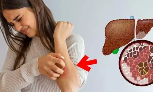 Fatty Liver : ముఖంలో వాపు, శరీరంపై దురద.. ఈ వ్యాధి సంకేతం కావచ్చు!