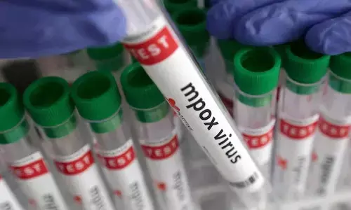 Mpox: కర్ణాటకలో మంకీపాక్స్ కలకలం.. దుబాయ్ నుంచి వచ్చిన వ్యక్తికి పాజిటివ్ !