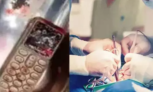 సెల్‌ఫోన్ మింగేసిన మహిళ.. ఆ తర్వాత ఏమైందంటే?