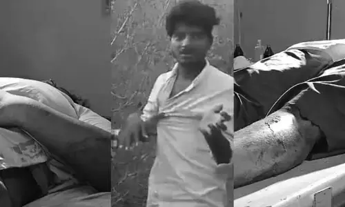 Attack: ప్రేమోన్మాది ఘాతుకం.. యువతిపై కర్రతో విచక్షణారహితంగా దాడి