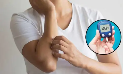 Health: స్కిన్ ఇన్ఫెక్షన్స్ తగ్గట్లేదా..? షుగర్ లెవెల్స్ కంట్రోల్లో లేవేమో!