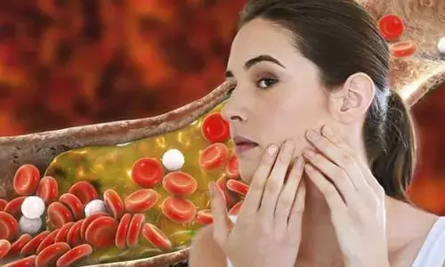 Bad Cholesterol : ఈ లక్షణాలు కనిపిస్తే బీ కేర్ ఫుల్.. మీలో ఆ సమస్య ఉన్నట్టే!