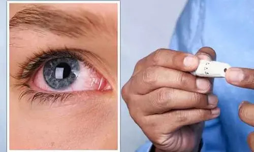 Eyes : కళ్లల్లో ఈ లక్షణాలు కనిపిస్తే బీ కేర్ ఫుల్.. శరీరంలో ఆ సమస్య ప్రారంభమైనట్టే!