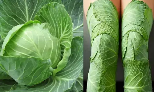 cabbage: పచ్చి క్యాబేజీ తింటే ఏమవుతుంది.. తలెత్తే సమస్యలు ఏంటి?
