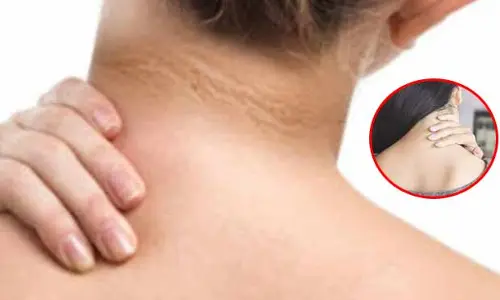 Black on the neck : మెడపై నలుపు పోవాలంటే..