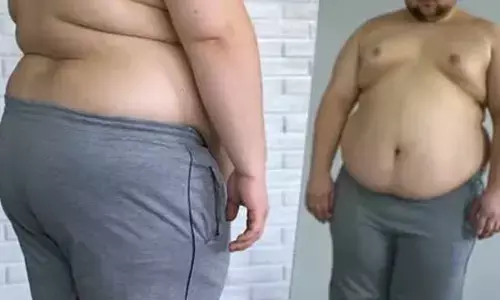 Overweight : వామ్మో.. లావెక్కిపోతున్నాంగా..!!