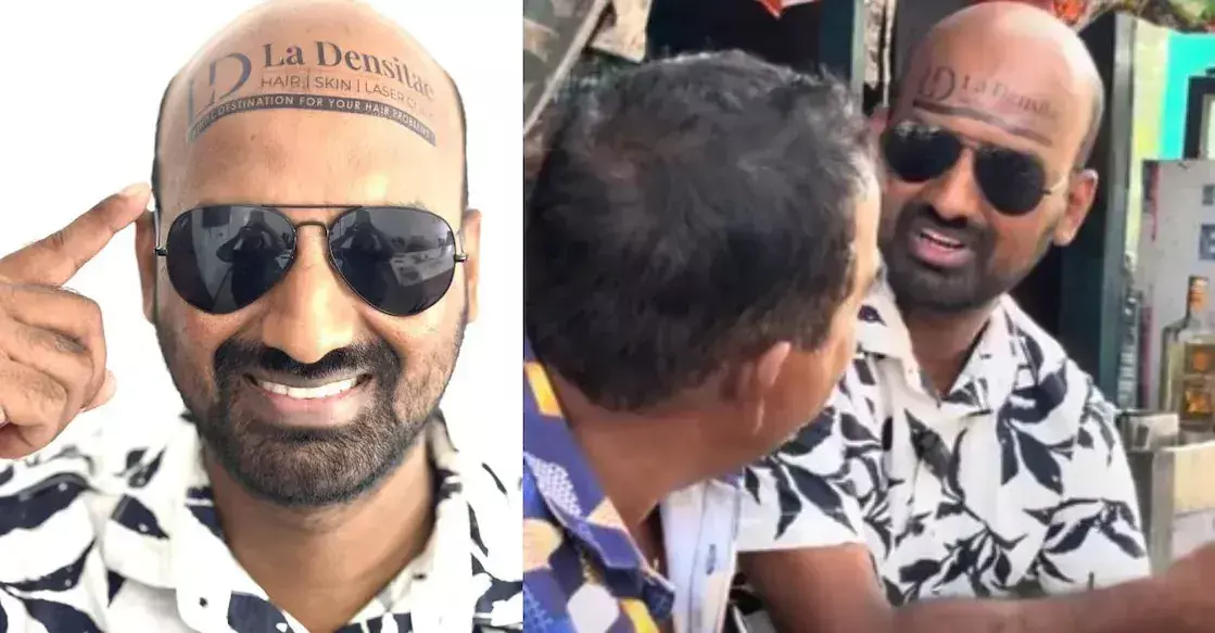 VIRAL : బట్టతల ఉందని బాధపడకు బ్రో.. లక్షల్లో సంపాదించే మార్గం ఇదిగో.. VIRAL : బట్టతల ఉందని బాధపడకు బ్రో.. లక్షల్లో సంపాదించే మార్గం ఇదిగో..