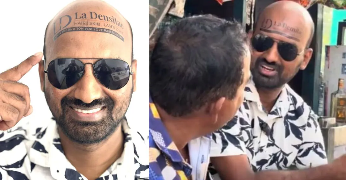 VIRAL : బట్టతల ఉందని బాధపడకు బ్రో.. లక్షల్లో సంపాదించే మార్గం ఇదిగో..