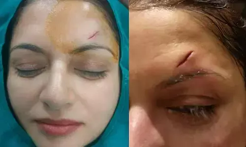 ఆస్పత్రి బెడ్‌పై దర్శనమిచ్చిన అలనాటి హీరోయిన్.. ఏకంగా 13 కుట్లు పడడంతో ఆందోళనలో ఫ్యాన్స్