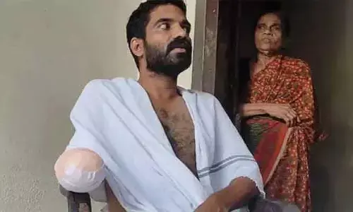 అమ్మో.. చేప కొరికితే ఇంత డేంజరా? చేతినే తొలగించారుగా..!