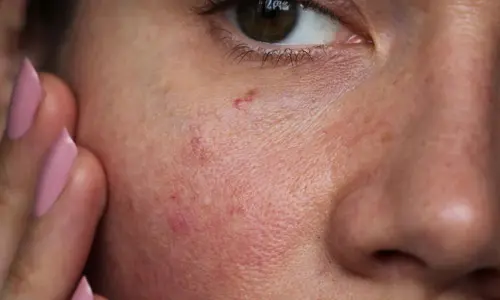Skin: మీ చ‌ర్మం మెరిసిపోవాలంటే.. వీటిని పాటించండి..!