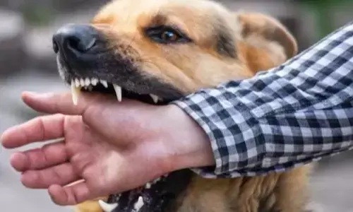 Rabies: దేశంలో పెరిగిన రేబిస్ మరణాలు.. ప్రతి నెలా నలుగురు మృతి !