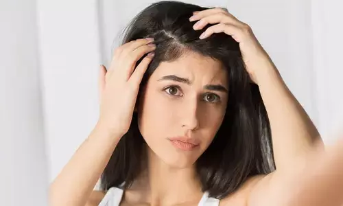Hair: మన జుట్టులో పోషక లోపాలను సూచించే  6 సంకేతాలు..!