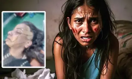 Brutal incident: ఆమె ముఖంపై దాదాపు 250 కుట్లు.. ఢిల్లీలో మహిళపై దారుణ ఘటన (ఫోటో)