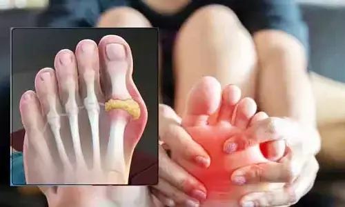 Uric Acid: శరీరంలో యూరిక్ యాసిడ్‌ను సహజంగా తగ్గించే 5 వేసవి పండ్లు