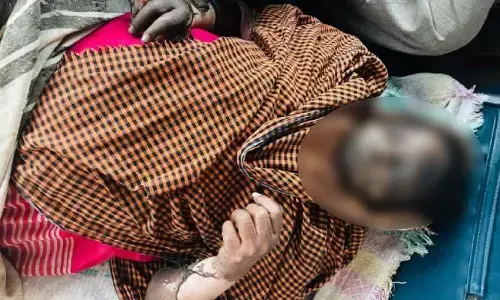 ప్రమాద వశాత్తు మంటలంటుకొని మహిళకు తీవ్రగాయాలు...