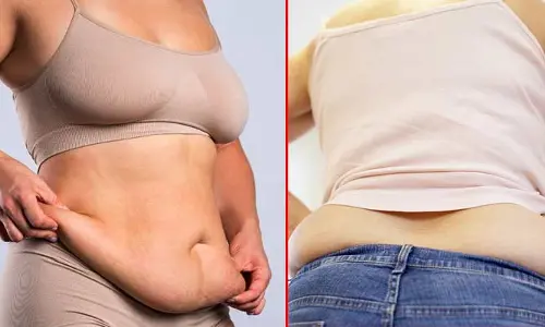 Body fat : బాడీలోని ఆ పార్ట్స్‌పై కొవ్వు పెరిగితే..?