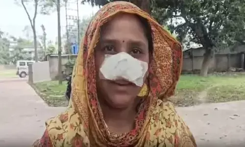Viral News: నైటీలో ఉన్న భార్య.. ఆ పార్ట్ కొరికేసిన భర్త! రాష్ట్రమంతా రచ్చ రచ్చ