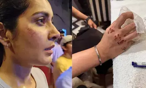 Raashi Khanna: రాశీ ఖన్నాకు గాయాలు.. ఆందోళనలతో అభిమానులు!