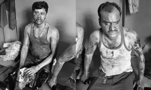 ఎన్టిపిసి ప్లాంట్ లో ప్రమాదం..ఇద్దరు కాంట్రాక్ట్ కార్మికులకు తీవ్ర గాయాలు