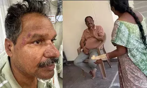 దుమ్ము దూళి వస్తుందంటే.. దమ్ము చూపించాడు.. మాజీ కార్పొరేటర్ కొత్త రూల్..!