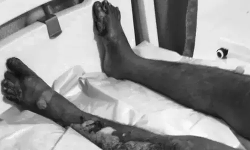 భువనగిరి ఆర్టీఏ కార్యాలయంలో ప్రమాదం...