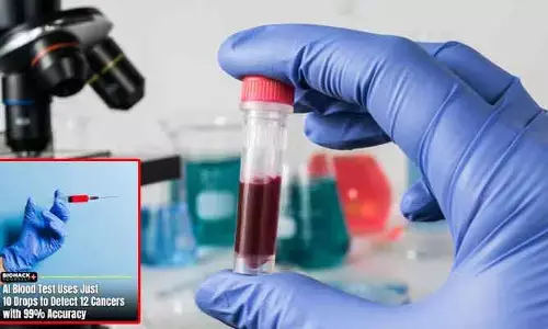 Cancer diagnosis : 99% కచ్చితత్వంతో 12 రకాల క్యాన్సర్లను గుర్తించే ఏఐ ఆధారిత బ్లడ్ టెస్ట్.. శాస్త్రవేత్తల సరికొత్త ఆవిష్కరణ
