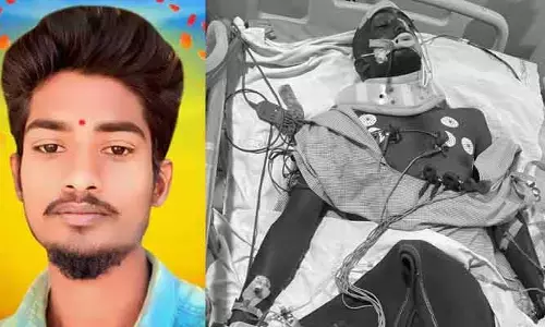 చికిత్స పొందుతూ గీత కార్మికుడు మృతి
