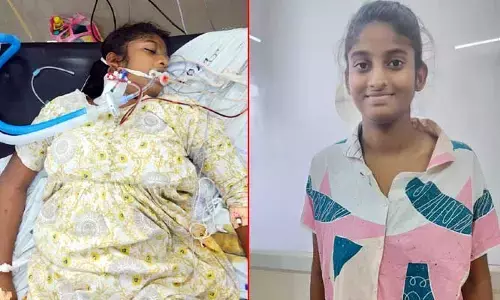 యువతికి పునర్జన్మను ప్రసాదించిన ‘ఉస్మానియా’ డాక్టర్లు
