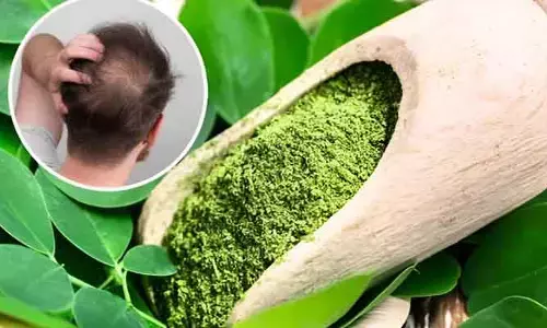 Baldness : ఆ చెట్టు ఆకులను ఇలా వాడితే చాలు.. 12 వారాల్లో బట్టతల మాయం..!