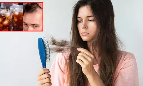 Hair loss : జుట్టు రాలే సమస్యను పెంచుతున్న చక్కెర పానీయాలు, ఆల్కహాల్.. అధ్యయనంలో వెల్లడి