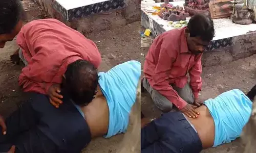 VIDEO: కిడ్నీ స్టోన్స్ బాబా.. ఎంత పెద్ద స్టోన్ ఉన్నా నోటితోనే బ్లాస్టింగ్
