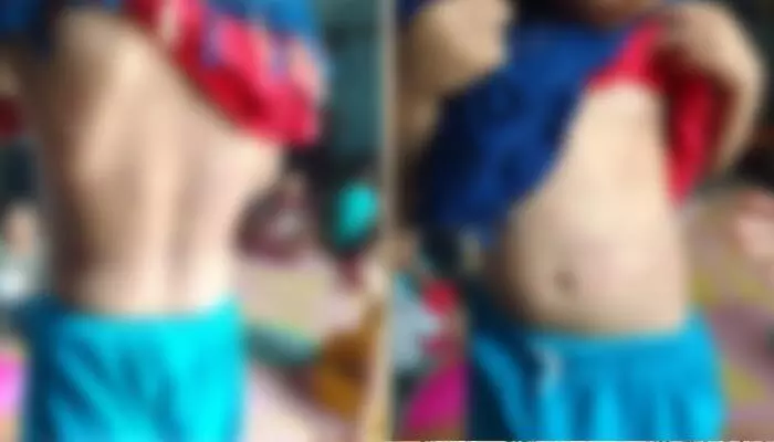 మియాపూర్లో 3 ఏళ్ల చిన్నారిపై దారుణం.. ప్రియుడితో కలిసి కన్న కూతురిని వేధించిన తల్లి మియాపూర్లో 3 ఏళ్ల చిన్నారిపై దారుణం.. ప్రియుడితో కలిసి కన్న కూతురిని వేధించిన తల్లి