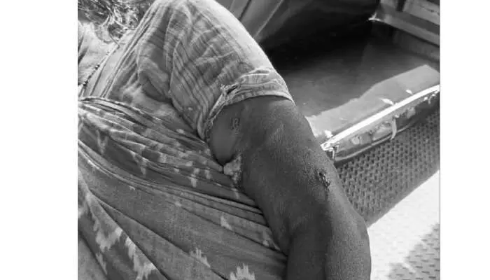 పిచ్చికుక్క దాడి.. ఏడుగురికి గాయాలు పిచ్చికుక్క దాడి.. ఏడుగురికి గాయాలు