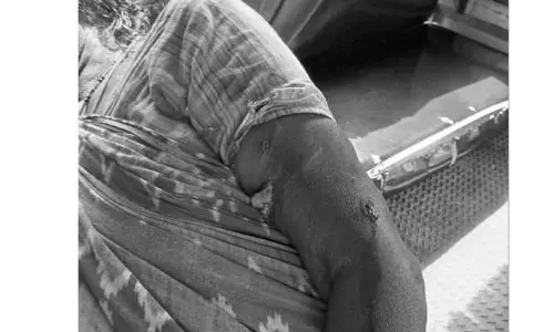 పిచ్చికుక్క దాడి.. ఏడుగురికి గాయాలు
