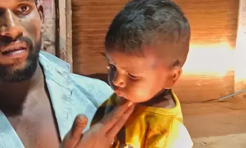 ఆటో, టీవీఎస్ ఢీ.. ముగ్గురికి గాయాలు