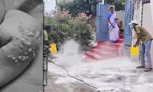రాష్ట్రంలో వింత వ్యాధి  కలకలం.... చిన్నారికి ఒంటి నిండా బొబ్బలు