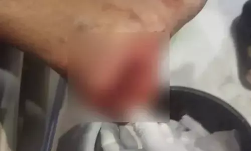 రైతుల నిర్ల‌క్ష్యం.. వాహ‌న‌దారుడికి గాయం..!