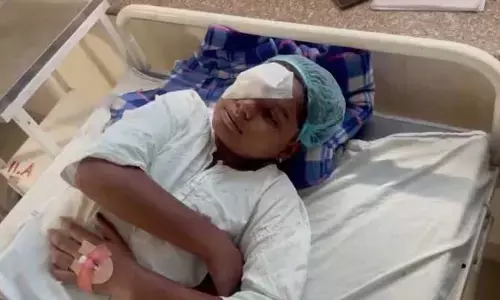 కార్బయిడ్ గన్స్ పేలి 150 మందికిపైగా గాయాలు.. కంటి చూపు కోల్పోయిన పలువురు!
