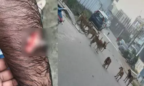 కుక్క‌ల దాడిలో న‌లుగురికి గాయాలు