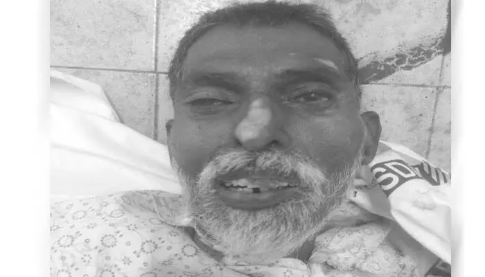 చికిత్స పొందుతూ వ్యక్తి మృతి