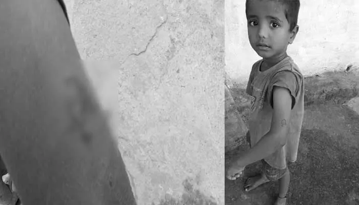 వీధి కుక్క కాటు.. భయాందోళనలో ప్రజలు వీధి కుక్క కాటు.. భయాందోళనలో ప్రజలు