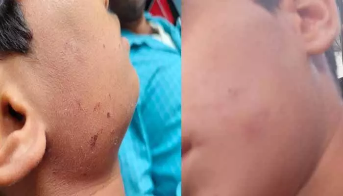 జీకే చెప్పలేదని విద్యార్థి పై ప్రధానోపాధ్యాయుడి పైశాచికం జీకే చెప్పలేదని విద్యార్థి పై ప్రధానోపాధ్యాయుడి పైశాచికం