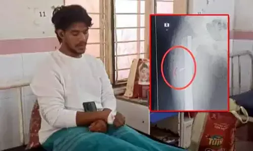 తునిలో దారుణం.. కాలుకు ఆపరేషన్ చేసి బ్లేడ్ మర్చిపోయిన డాక్టర్లు